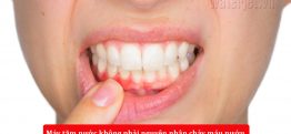 Dùng máy tăm nước có làm chảy máu nướu không? Cách khắc phục hiệu quả