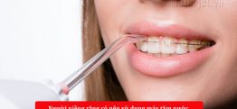 Máy tăm nước có phù hợp cho người niềng răng không? Lời khuyên từ nha sĩ